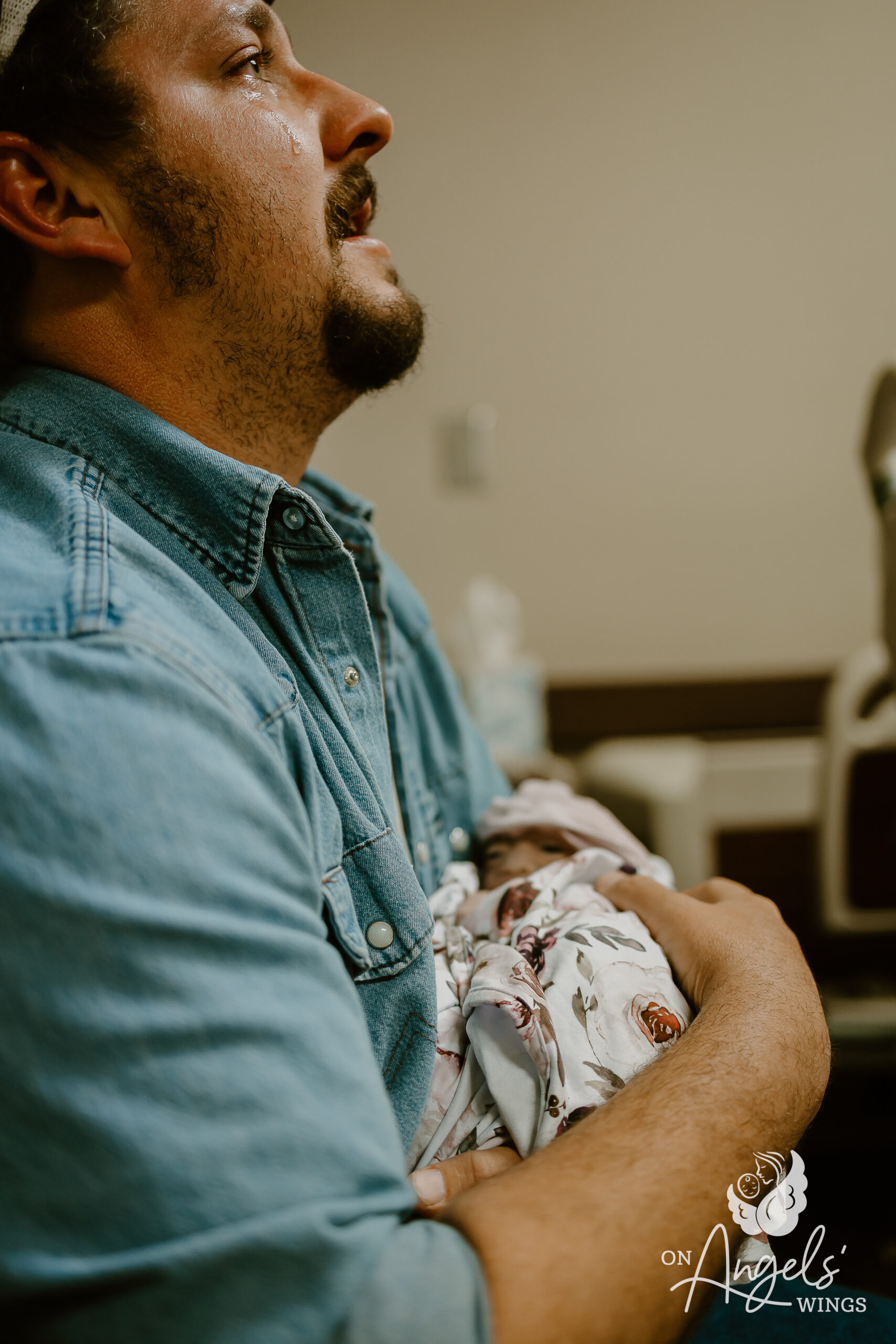 What is Anencephaly? - On Angels Wings